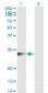 RAB7B Antibody (monoclonal) (M01)